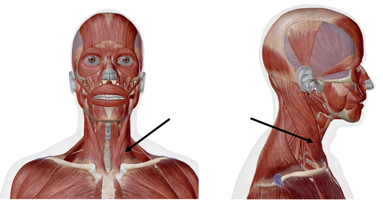 <p>Identify the name of the muscle that the arrow is pointing to in the image.</p>