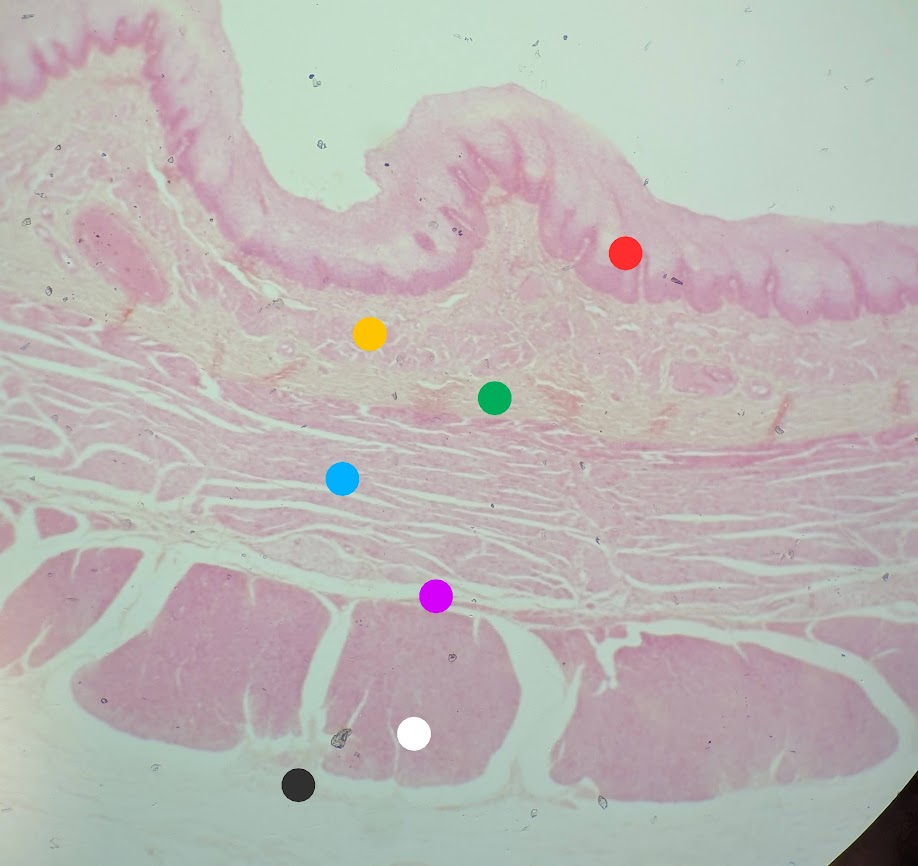 <p>Where in the body is this</p>