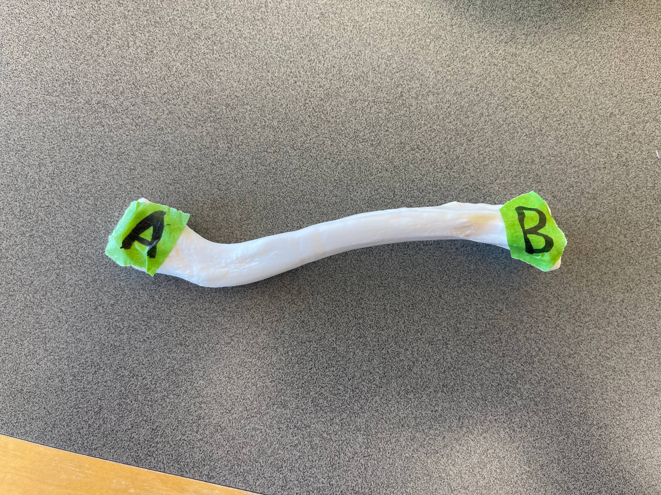 <p>Which side of the body is this on?</p>