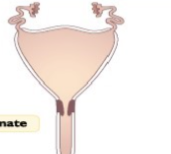 <p>Which species do we see this uterus in, describe it</p>