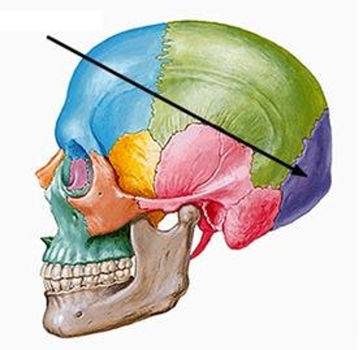 <p>ID bone at arrow</p>