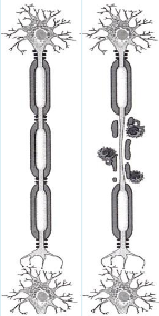 <p>It involves inflammation, demyelination, and neuronal/axonal damage in the brain and spinal cord, disrupting nerve signal transmission and leading to motor, sensory, visual, and autonomic dysfunction.</p>