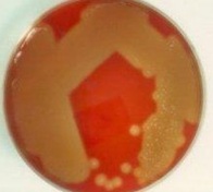 <p>What would be the next step in Identification of the bacterium growing on this plate?</p>