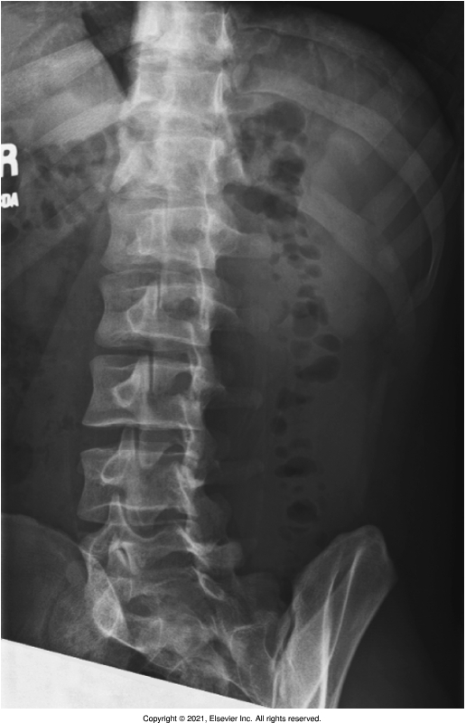 <p>t12-s1 to include costovertebral joints and SIJs</p>