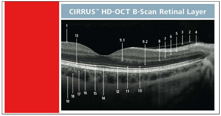 <p>Name the layers</p>