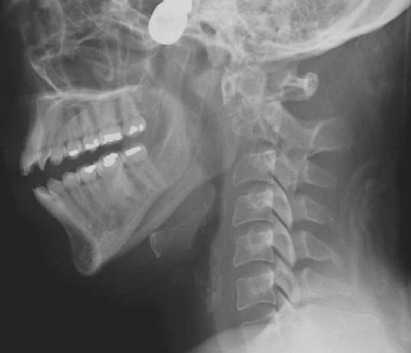 <p>What is the diagnosis?</p>