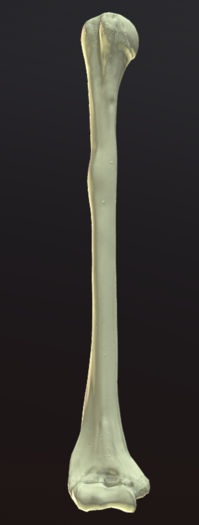 <p><span><strong>These bones came from the ________ side of the body.</strong></span></p>