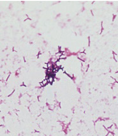 <p>what bacteria is best associated with the following information:</p><ul><li><p>gram positive diphtheroid/irregular </p><ul><li><p>rods terminate in clubs or thick, bifurcated (forked) ends</p></li><li><p>“<strong>dog bones</strong>”</p></li></ul></li><li><p>mostly nonpathogenic normal oral and intestinal flora </p><ul><li><p>most commonly found in mixed cultures of pelvis or abdomen </p></li></ul></li><li><p>used in yogurts/probiotics </p></li></ul><p></p>