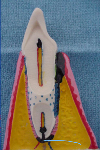 <p>What is this structure in the tooth</p>