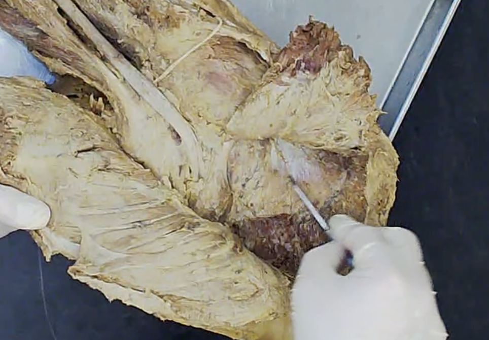 <p>Where he is pointing</p>