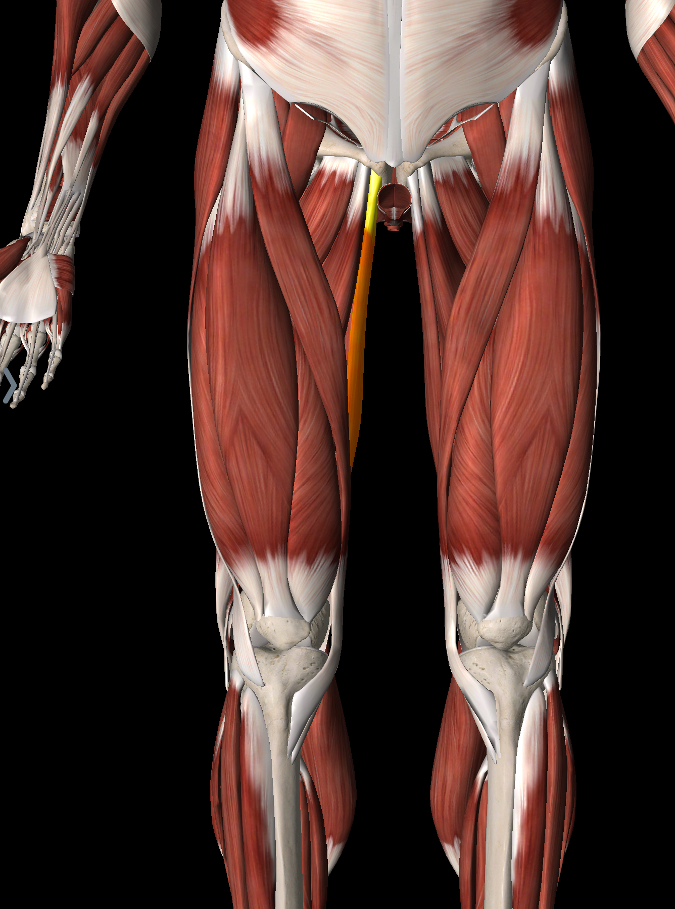 <p>What muscle is this?</p>