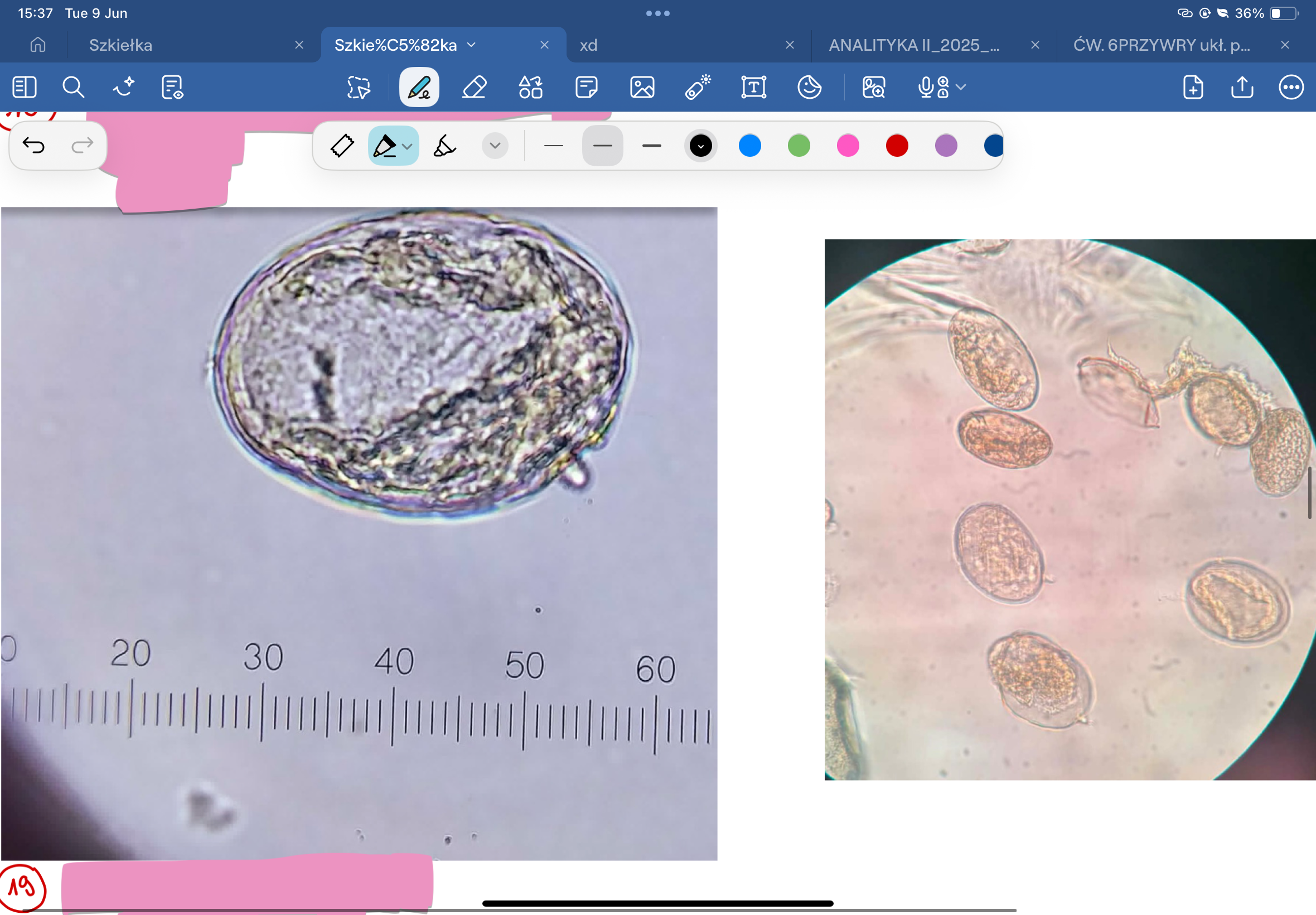 <p>co to za jajo</p>