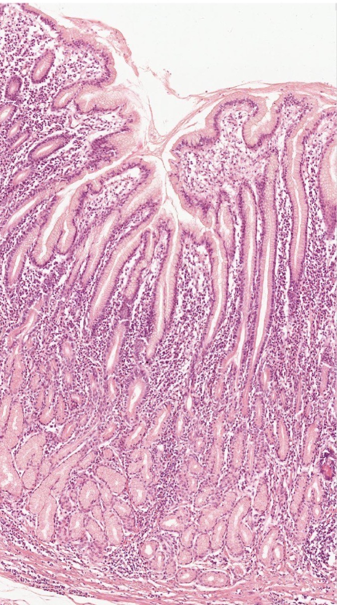 <p>What area of the stomach is this?</p>