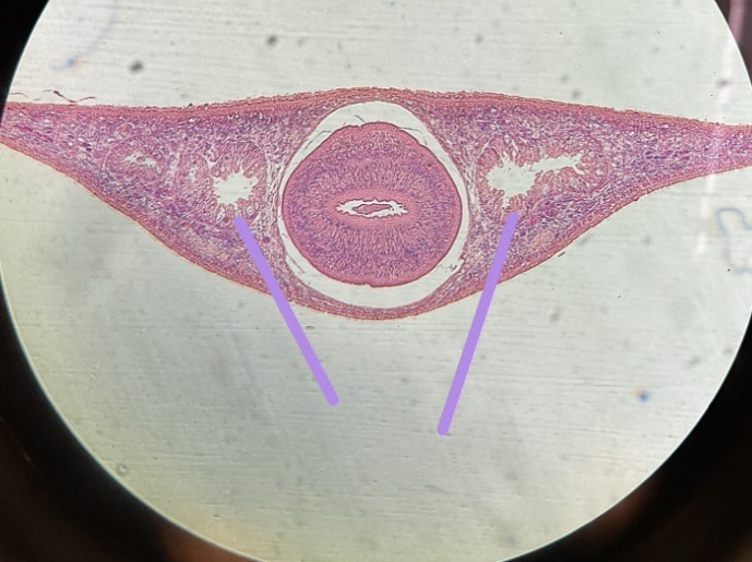 <p>What is this structure </p>