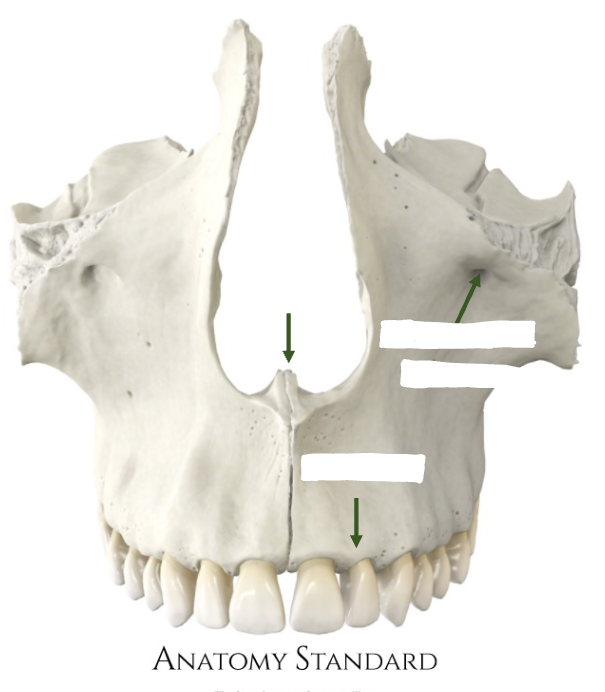 <p>labell 3 key features of the maxilla</p><p></p>