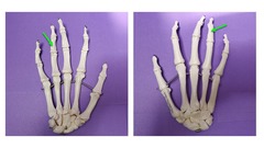 <p>specific bone name (multiple examples are indicated)</p>