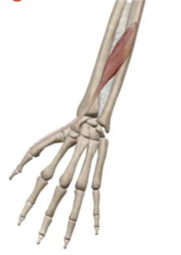 <p>what muscle and action is this </p>