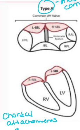 <p>The superior bridging leaflet is: Divided & Attached to the ventricular septum crest</p><p></p>