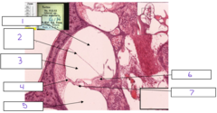 <p>What is the structure at 1</p>