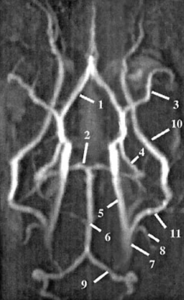 <p>Please label the circle of willis </p>
