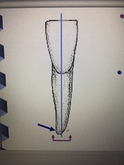 <p>Apical direction</p>