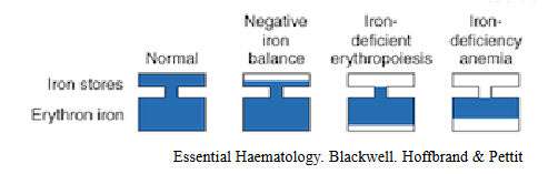 <p>- Negative iron balance - reduced iron stores, normal RBC iron, no anaemia</p><p>- iron deficient erythropoiesis - reduced iron stores, mildly reduced RBC iron, no anaemia</p><p>- iron deficiency anaemia - reduced iron stores, reduced RBC iron and anaemia</p>