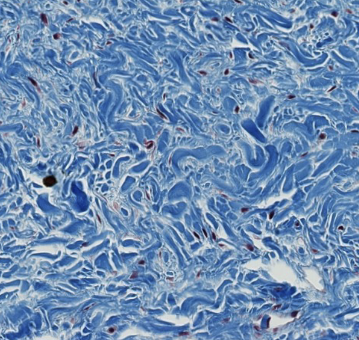<p>what type of CT is this? be specific.</p>