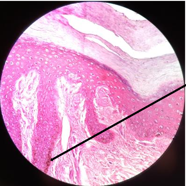 <p>melanocytes</p>
