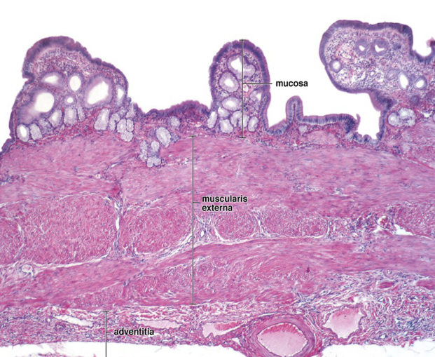 <ul><li><p>conc., store, sec. bile → 2nd part duodenum</p></li><li><p>CCK (contract), fatty food, vagus stim.</p></li><li><p>mucosa (<strong>simple columnar,</strong> LP), muscularis externa, adventitia/serosa</p><ul><li><p><strong>lacks muscularis mucosa + submucosa</strong></p></li><li><p><strong>only absorptive cell</strong></p></li></ul></li></ul><p></p>