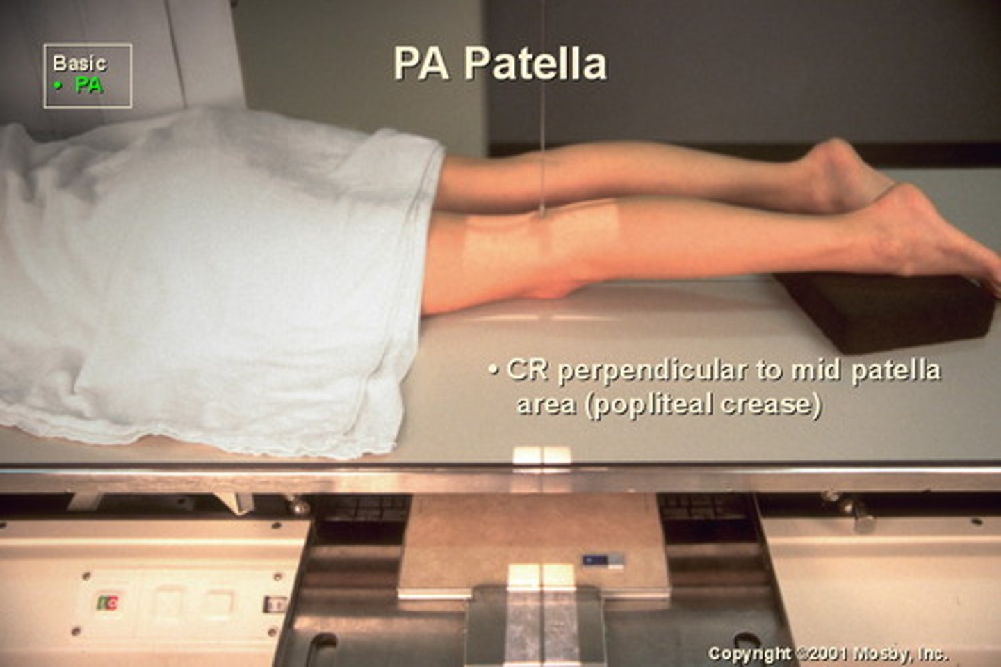 <p>S - over butt</p><p>T - 5 mAs @ 60 kVp</p><p>A - none</p><p>M - on cassette</p><p>P - PT prone, CR to mid patella</p><p>S - 40"</p><p>B - suspension</p><p>C - 10 x 12 lengthwise, 8 x 8 collimation</p>