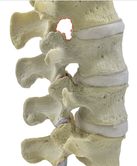 <p>Identify what’s highlighted in red</p>