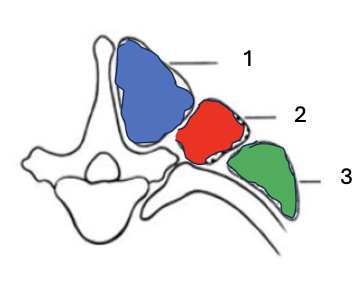 <p>What overarching muscle group is this? </p><p>What individual muscle groups are these?</p>
