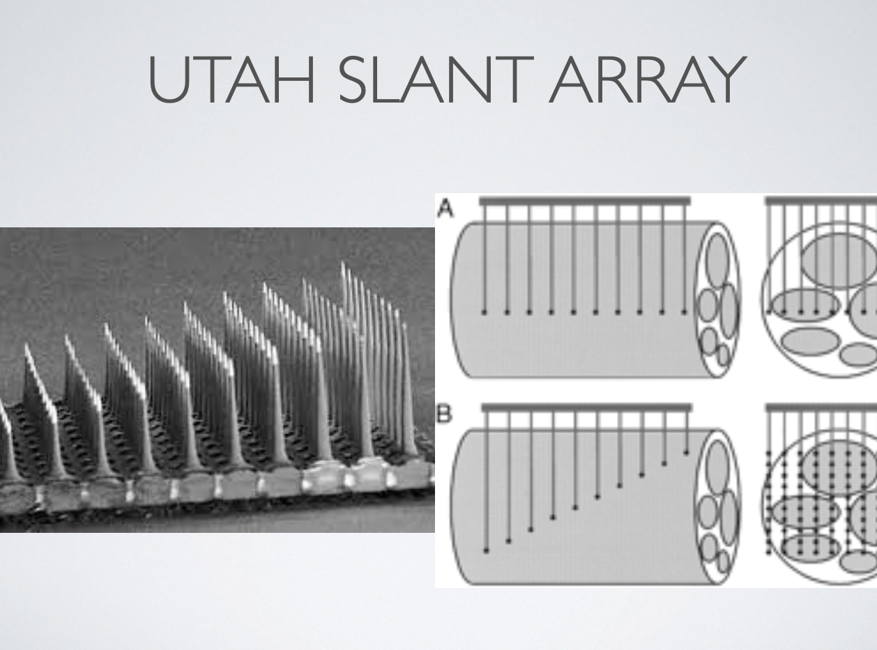 <p><span style="background-color: transparent;">has needles of different lengths that go into the nerve</span></p>