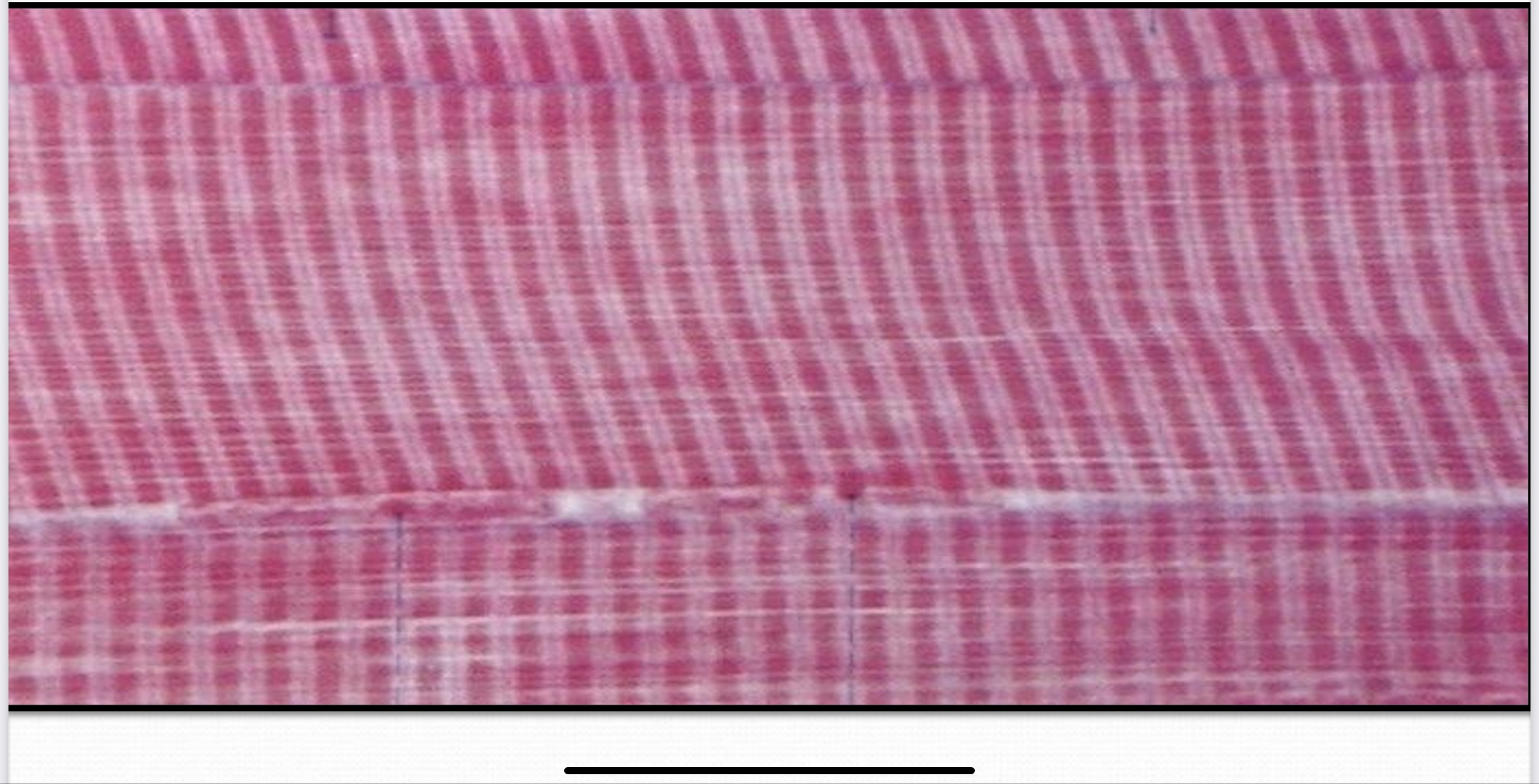 <p>Dense Yellow Elastic Connective Tissue</p>