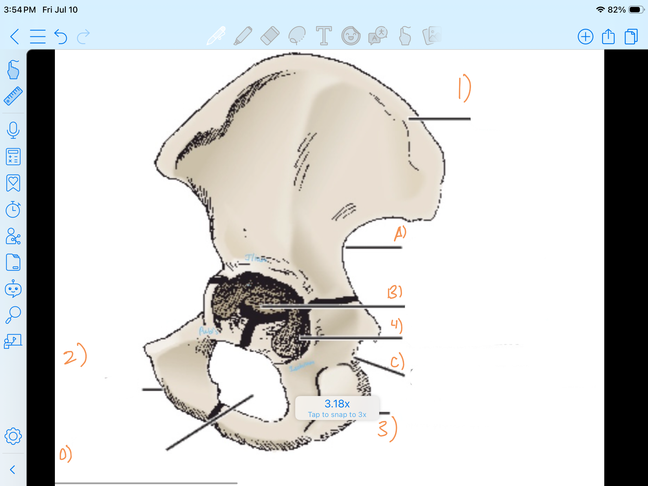 <p>What is each part of the image and what bones is it apart of?</p>