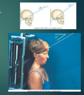 <p>AP AXIAL (SEATED OML or IOML PERP)</p><p></p><p>PA AXIAL ramus (sup OML PERP)<br>PA AXIAL body (sup AML PERP)</p>