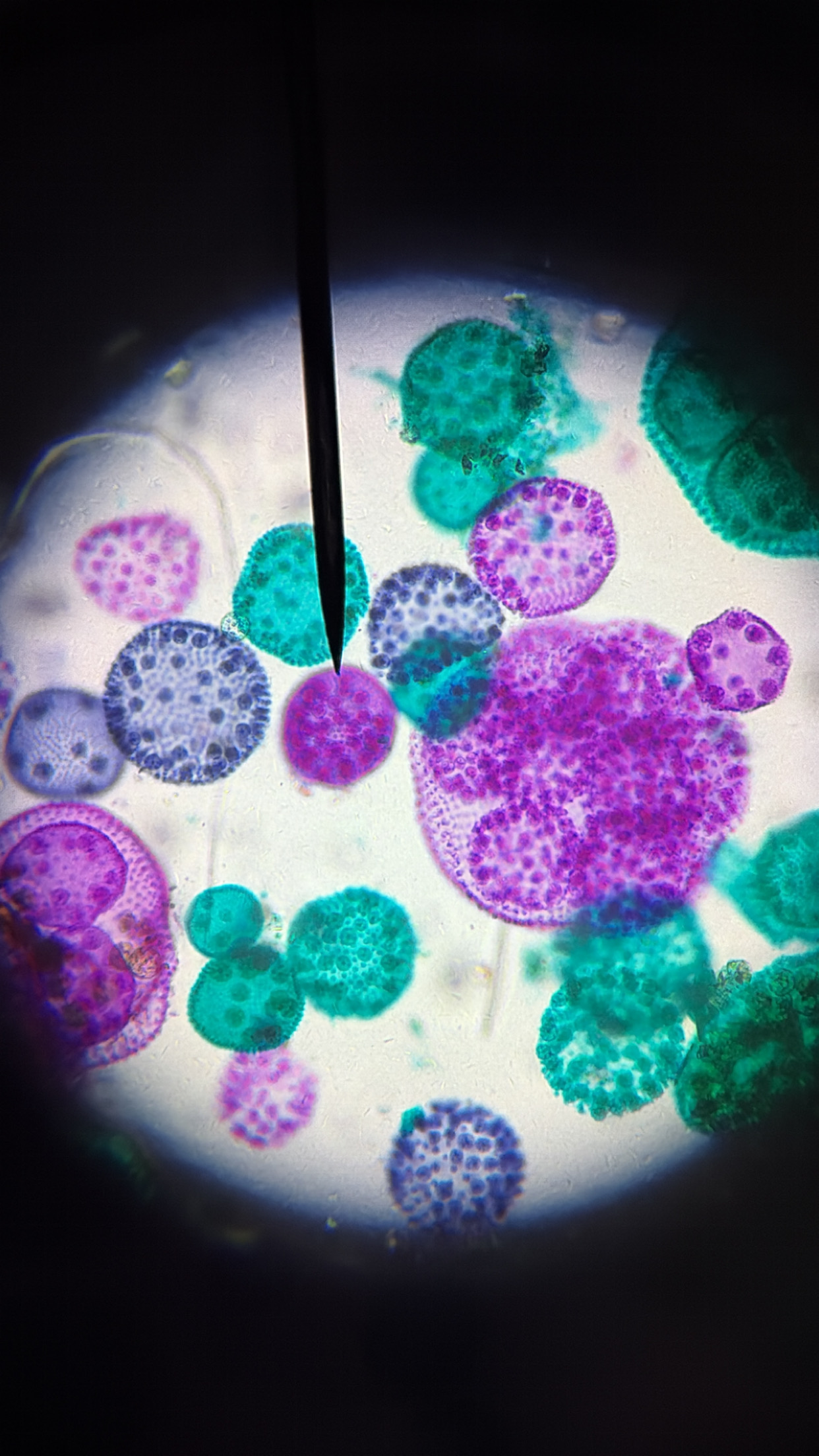 <ol><li><p>This slide shows a/an:</p></li></ol><p class="p1">a) Prokaryotic cell</p><p class="p1">b) Eukaryotic cell</p><p class="p1">c) None of the above</p><ol start="2"><li><p class="p1">Which type of cells does this slide show?</p><p class="p1">a) Cocci cells</p><p class="p1">b) Bacilli cells</p><p class="p1">c) Spirilli cells</p><p class="p1">d) None of the above</p></li></ol><ol start="3"><li><p class="p1">Which type of cell does this slide show an example of:</p></li></ol><p class="p1">a) Spirogyra</p><p class="p1">b) Volvox</p><p class="p1">c) Diatoms</p><p class="p1">d) None of the above</p><ol start="4"><li><p class="p1">Which type of cell does this slide show an example of:</p><p class="p1">a) Amoeba</p><p class="p1">b) Paramecium</p><p class="p1">c) None of the above</p></li><li><p class="p1">Which type of cell does this slide show an example of:</p><p class="p1">a) Archaebacteria or Eubacteria</p><p class="p1">b) Plantae</p><p class="p1">c) Protista</p><p class="p1">d) Fungi</p><p class="p1">e) Animalia</p></li></ol><p class="p1"></p><p class="p1"></p>