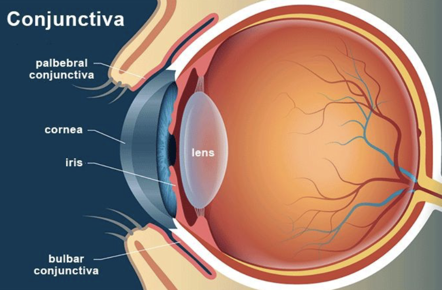 <p>Clear transparent dome in the front of the eye made of a connective tissue containing collagen fibrils embedded in proteoglycan rich extra fibrillar matrix (not vascularized). Epithelia cells produce mucin and cells create tight junctions</p>
