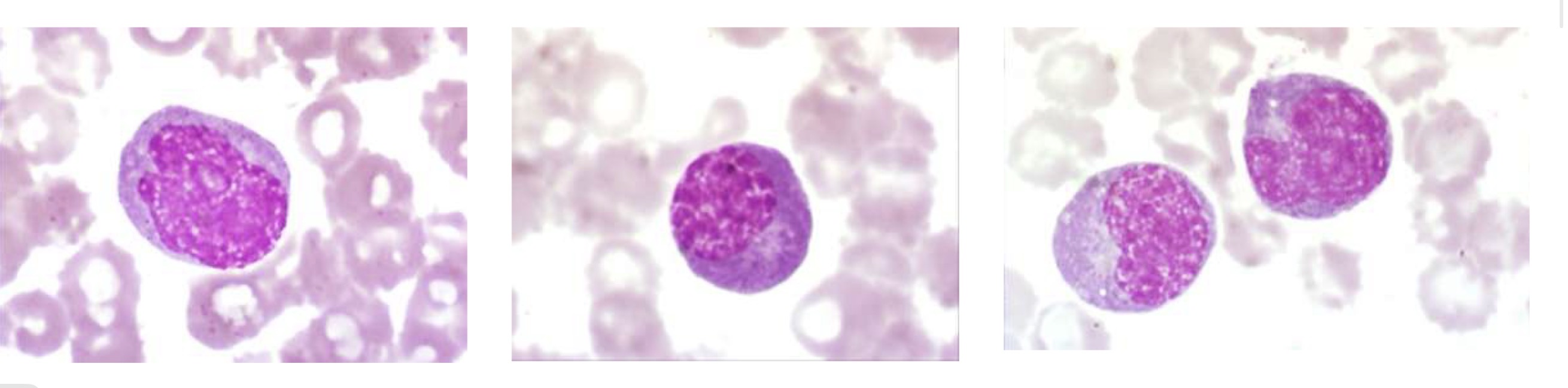 <p>Name this cell and the main points for identification</p>