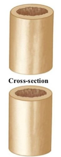 <p>transverse section (or cross-section)</p>