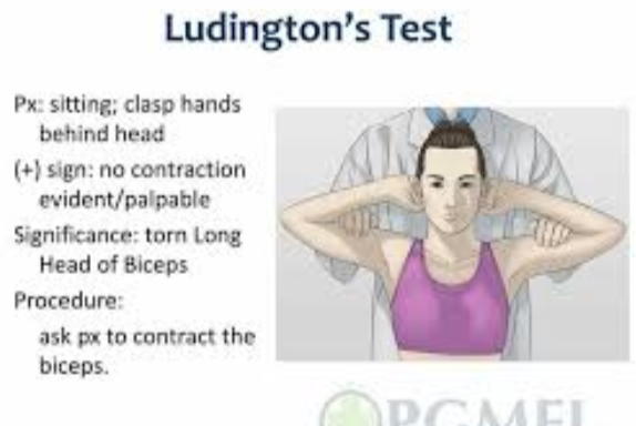<p>Put both hands behind your head. Tighten your arms like you’re flexing. If the biceps muscle doesn’t tighten or feels uneven, it’s positive.</p>