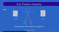<p>When a patient has an ESO deviation, how will the patient move this target (see pic) in order to get the lines to subjectively align?</p>