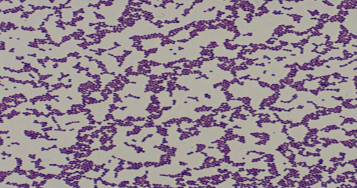 <p>Specimen (microscopically slide):</p><p>• Name of organism:</p><p>• Stain:</p><p>• Sample from: culture or pus or in tissue</p><p>• Morphology</p>