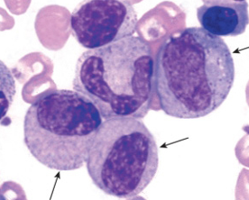 <p>What is this cell according to neutrophil maturation and where would you see it?</p>