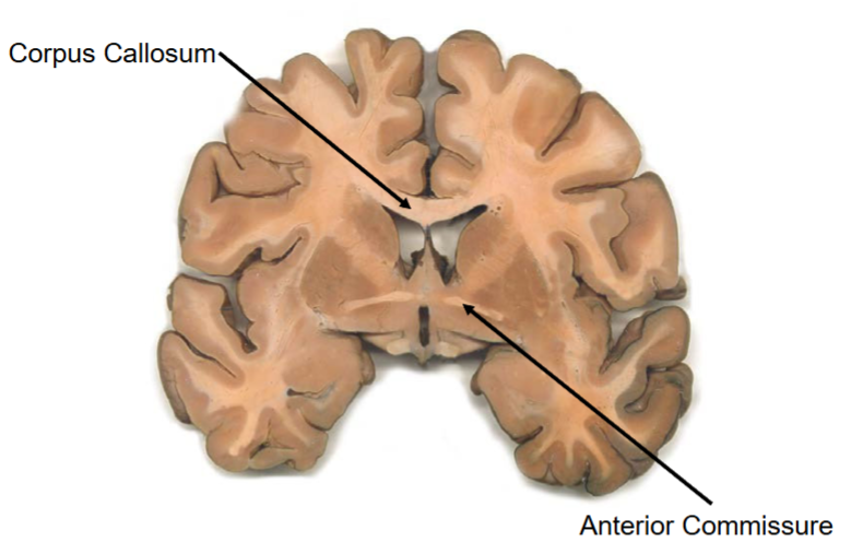 <p>Corpus callosum, anterior commissure</p>