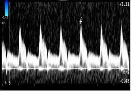 <p>What can be done to reduce the spectral broadening on the image?</p>