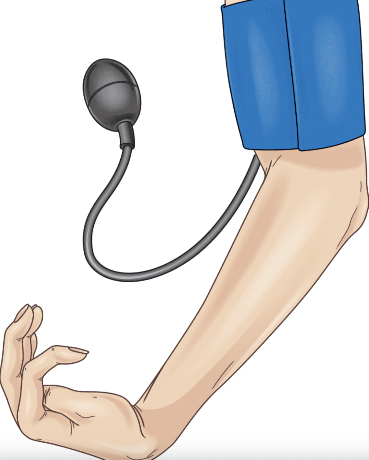 <p>BP cuff is tightened. there are spasms in the hand. what is this test called &amp; what does a positive result mean?</p>