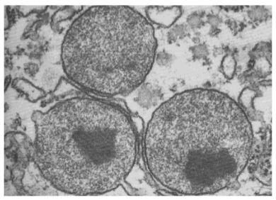 <p> Organellen gevormd door afsnoering van het S.E.R. Omgeven door één enkele membraan (geen dubbele membraan zoals mitochondriën, geen interne membranen). Op E.M.-foto's herkenbaar aan kristallijn materiaal (vaak katalase-enzymen) — zo te onderscheiden van primaire lysosomen.</p><p class="font-claude-response-body break-words whitespace-normal leading-[1.7]">Voornaamste functie: oxidatieve afbraakreacties via oxidase-enzymen. Hierbij wordt O₂ opgenomen en H₂O₂ gevormd (toxisch bij overmaat). Andere substraten worden vervolgens afgebroken met behulp van dat H₂O₂ via peroxidase-enzymen. Overmaat H₂O₂ wordt geneutraliseerd door katalase: 2 H₂O₂ → 2 H₂O + O₂.</p><p class="font-claude-response-body break-words whitespace-normal leading-[1.7]">Worden samen met glyoxisomen ondergebracht in de groep van de <strong>microbodies</strong>.</p>