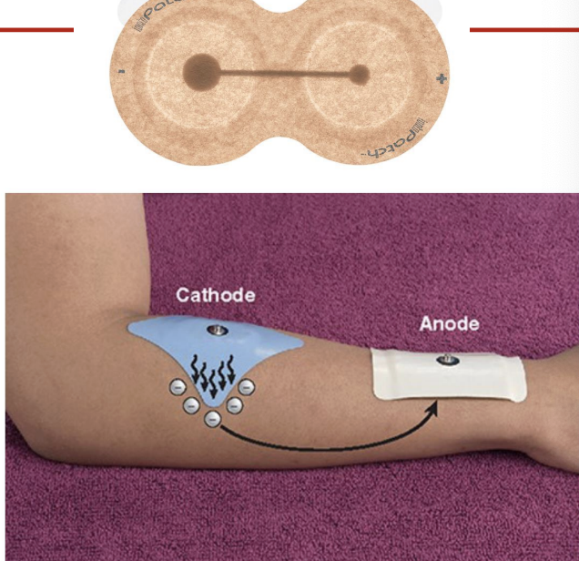 <ul><li><p>used to induce movement of ions across skin </p></li><li><p>delivers medicinal ion </p></li><li><p>typically uses DC current </p><ul><li><p>risk for burns</p></li></ul></li><li><p>soft tissue inflammatory conditions, neuralgia, edema, ischemic skin ulcers, hyperhidrosis, plantar warts, gouty arthritis, calciific tendonitis, scar tissue, Peyronie’s disease </p></li></ul><p></p>