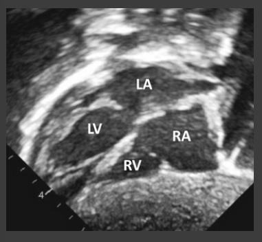 <p>what APEX AND THORACIC POSITION is this</p>